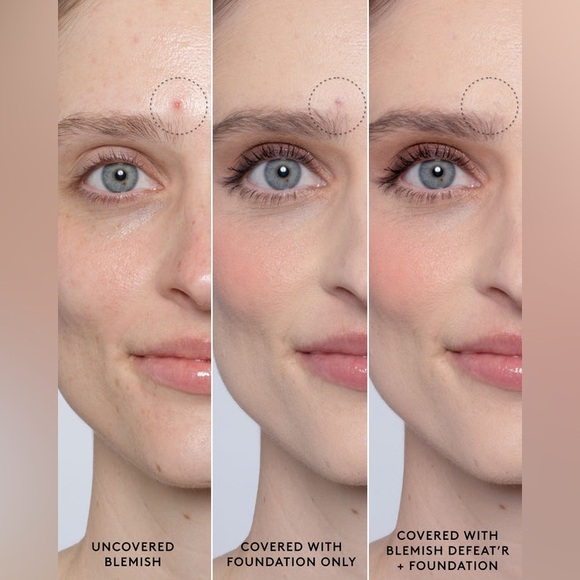 Fenty Beauty Blemish Defeat Cream - Picture 6 of 7